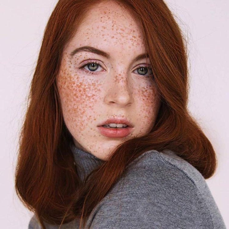 Freckles Джуди