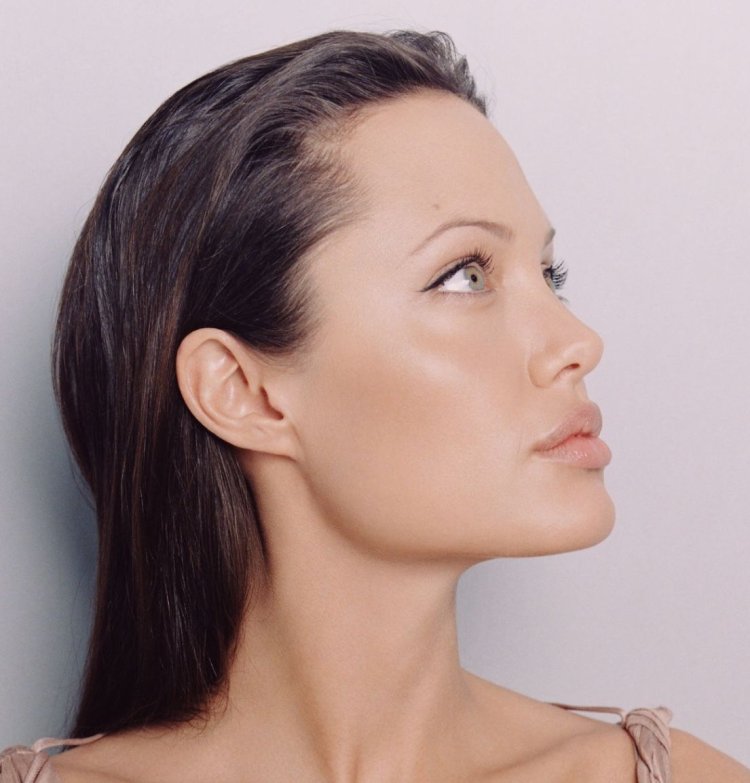 Скулы Анджелины Джоли косметология