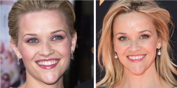 Риз Уизерспун пластика