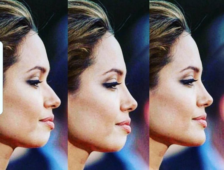 Нос Анджелины Джоли до и после в профиль