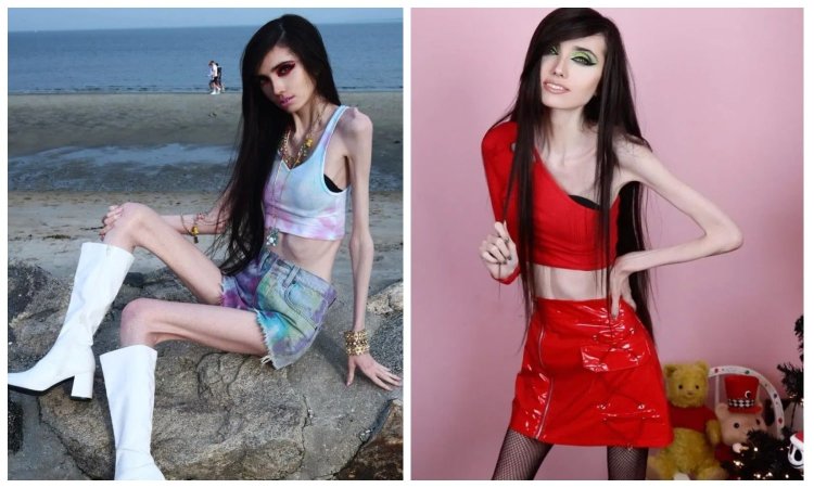 Eugenia Cooney Анорексичка
