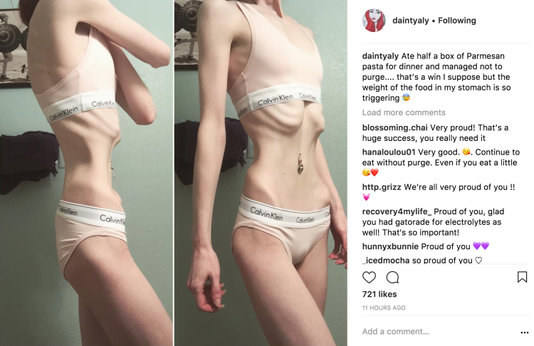 Холли Гриффитс анорексия