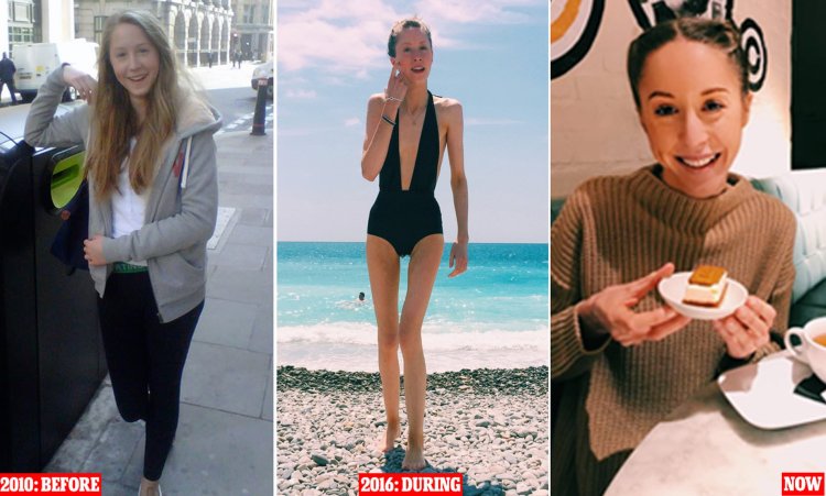 Эжени Бондюран анорексия