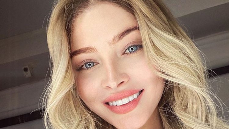 Алена Шишкова виниры