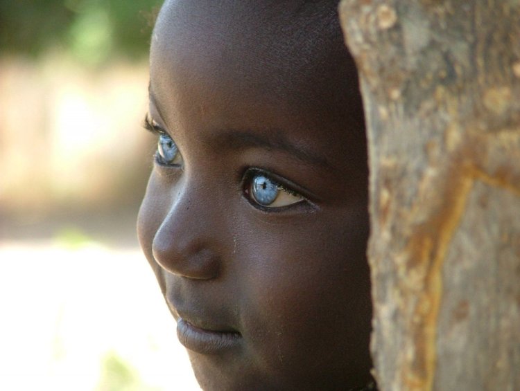 Темнокожие с голубыми глазами