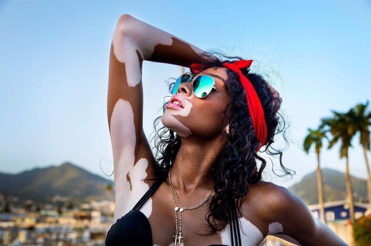 Шантель Браун-Янг