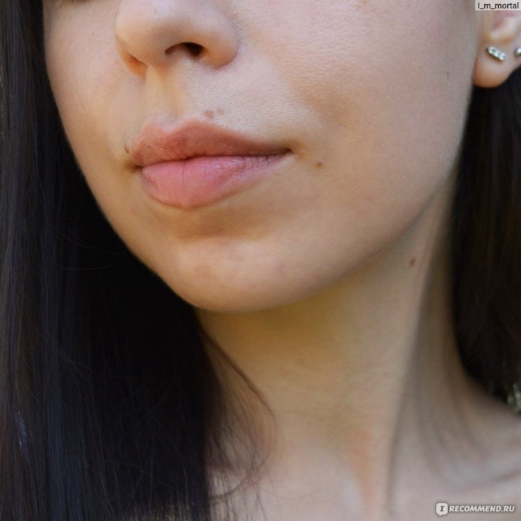 Шрам над губой