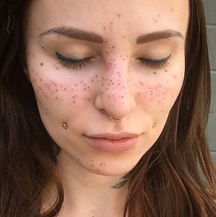 Татуаж веснушек