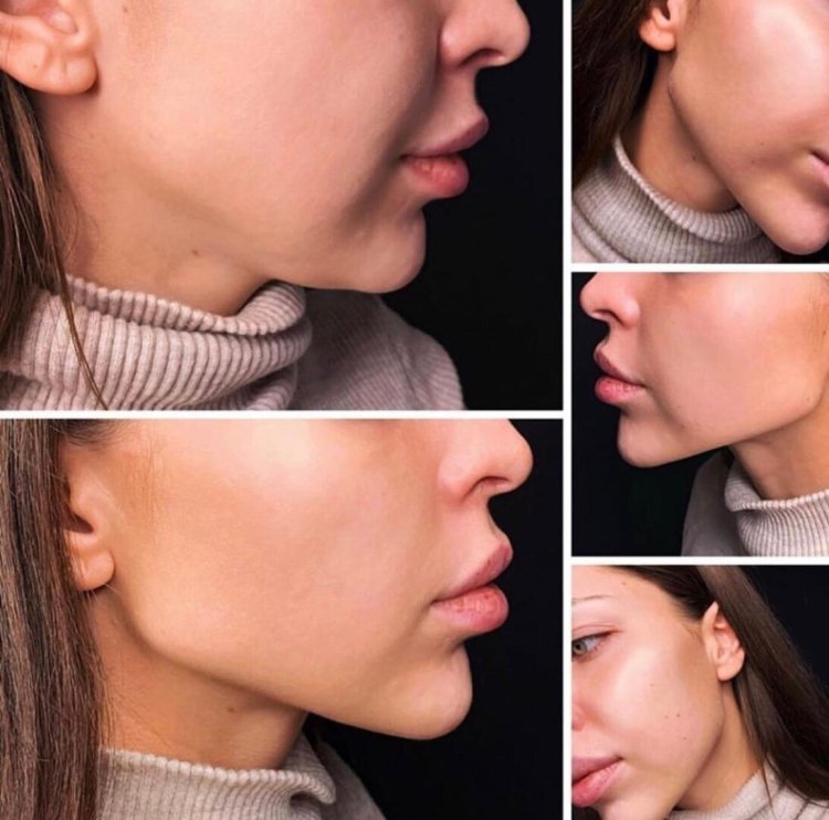 Профиль Джоли - углы нижней челюсти