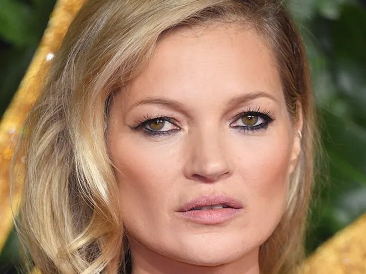 Кейт Мосс косоглазие