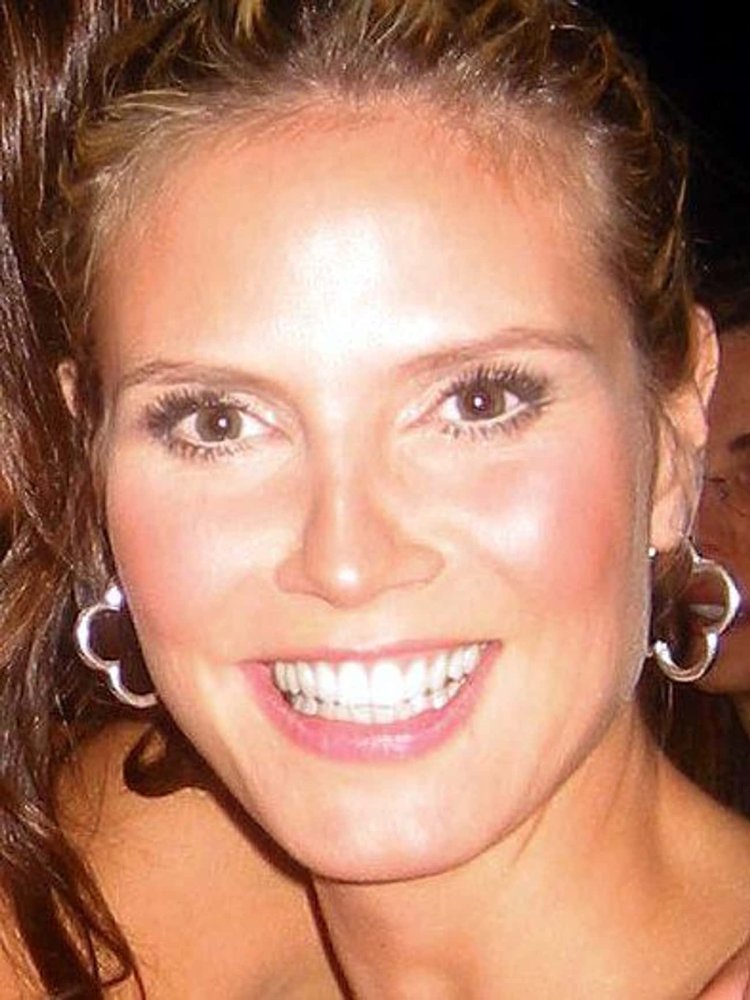 Косоглазие артистки