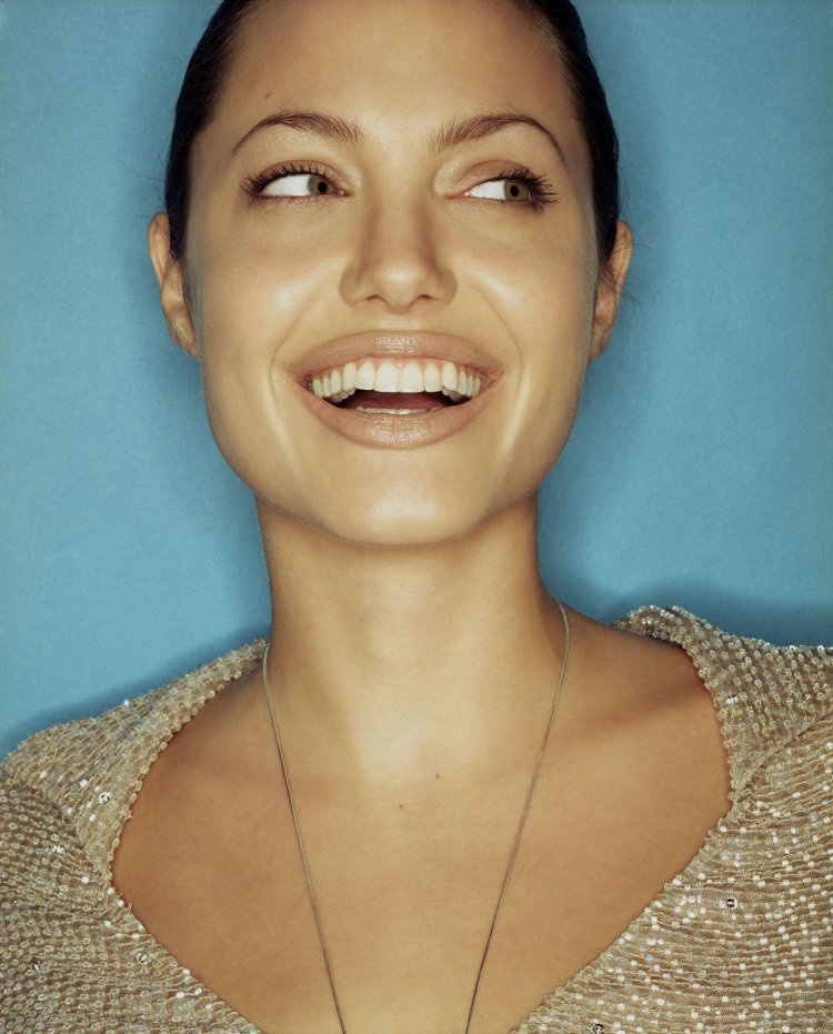 Джоли виниры