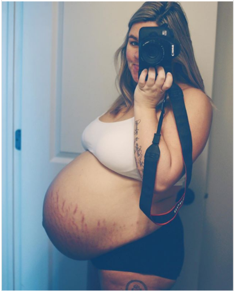 Живот у беременных