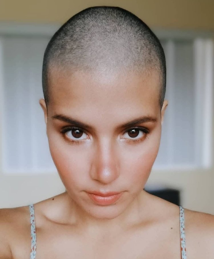 Лысая девочка