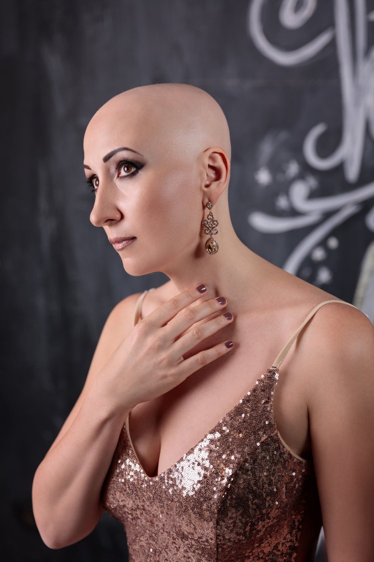 Диана чарогян лысая