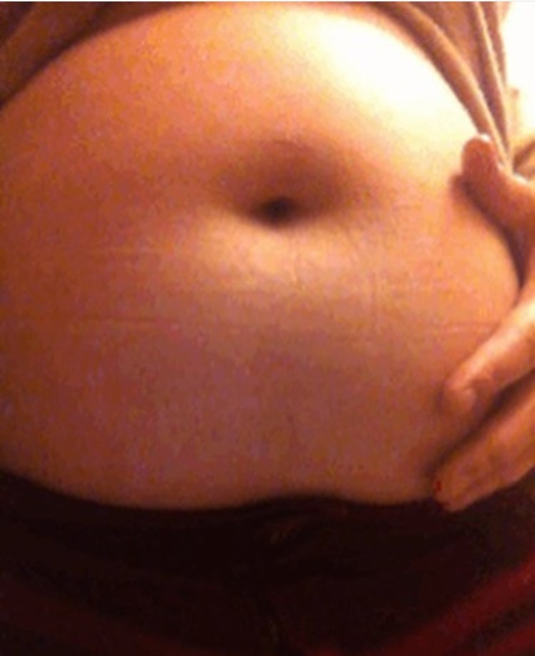 Надутый животик у девушки