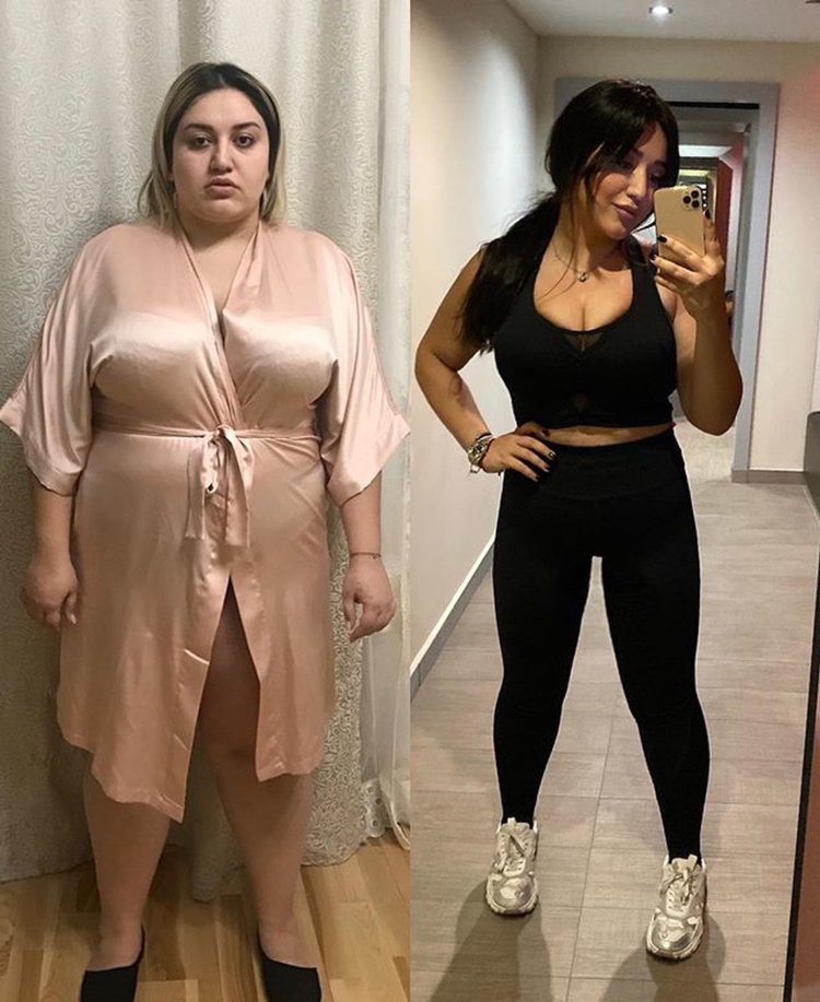 Гоар Аветисян толстая