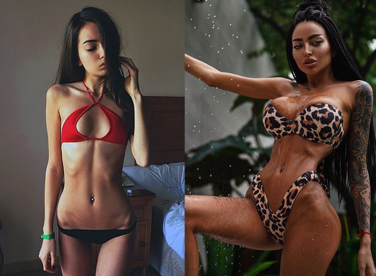 Алёна Омович до пластики