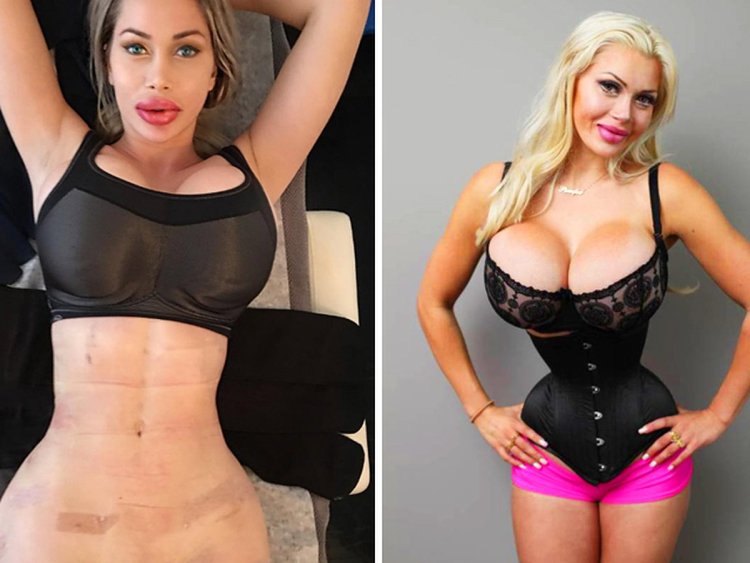 Пикси Фокс талия