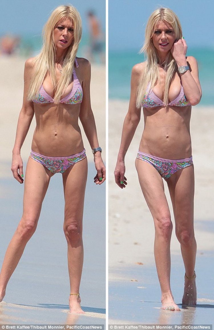 Тара Рид анорексия