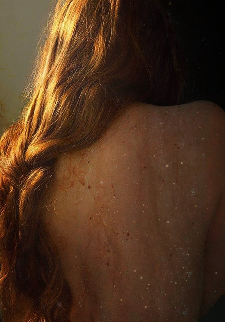 Пигментация лентиго