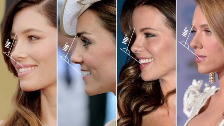 Кейт Миддлтон ринопластика