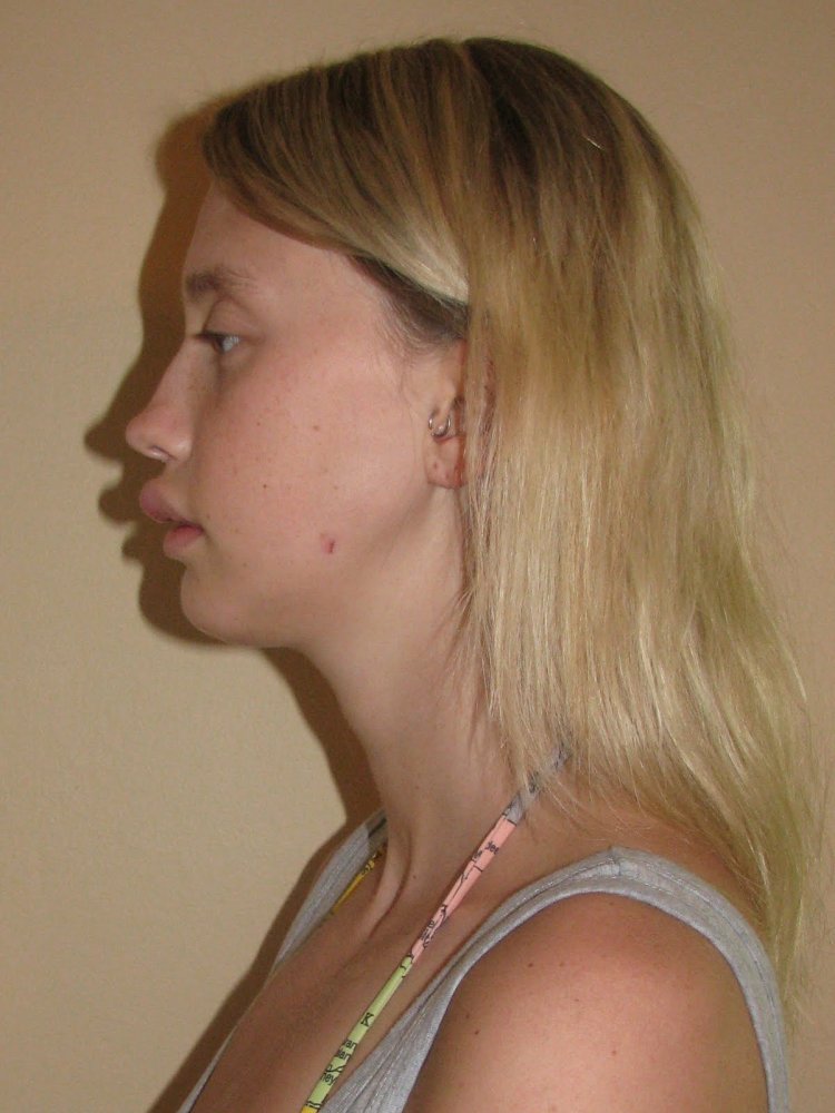 Греческий нос у девушек