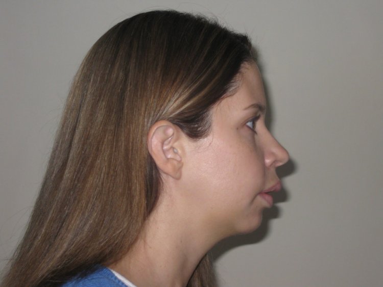 Длинный курносый нос