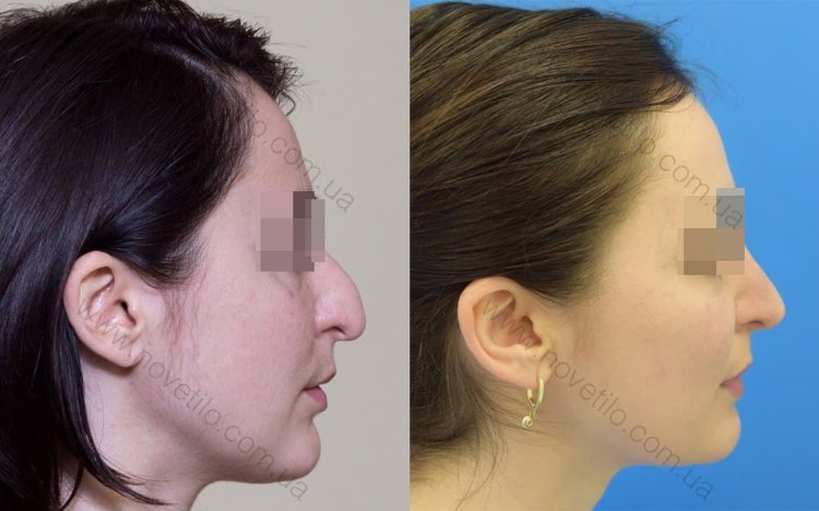 Нации с орлиными носами