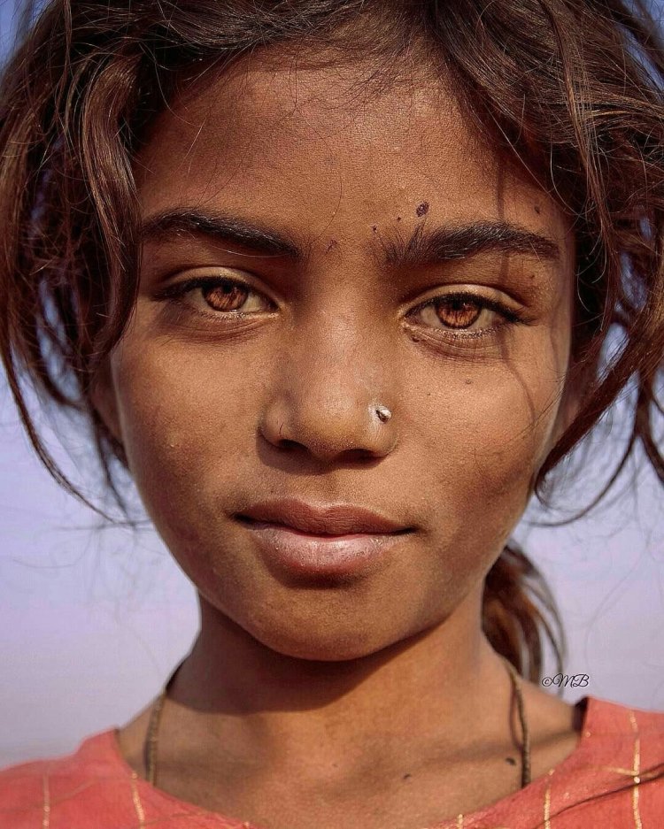 Необычные глаза у людей