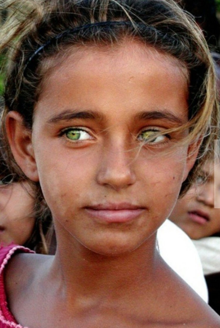 Необычные глаза у людей