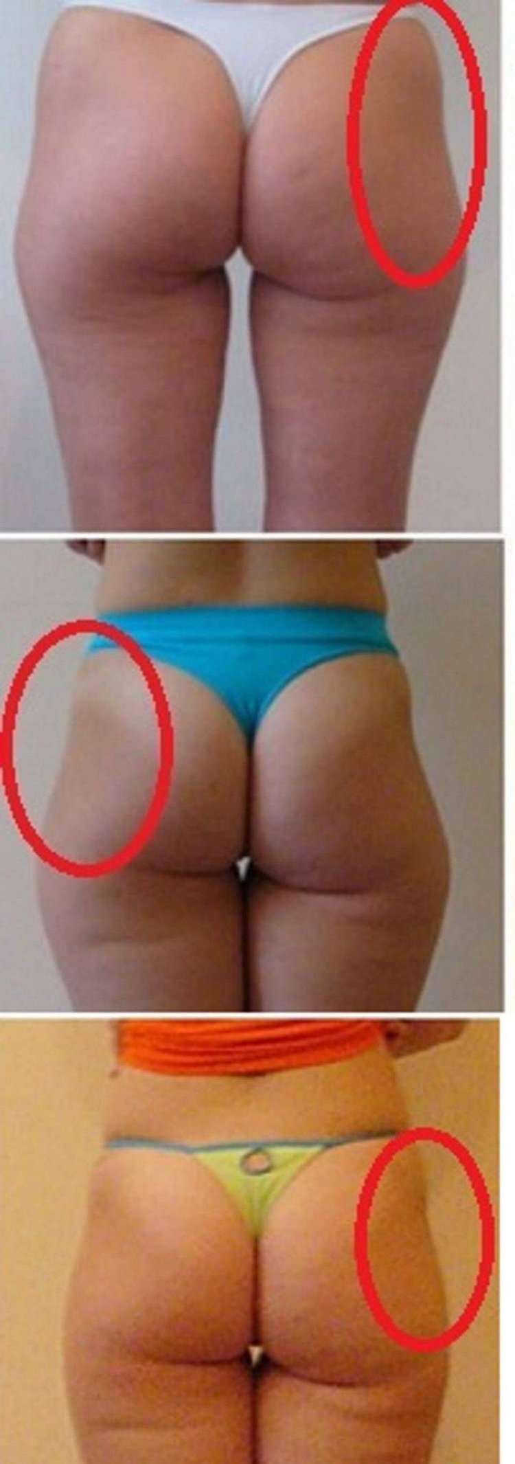 Ямочки на ягодицах