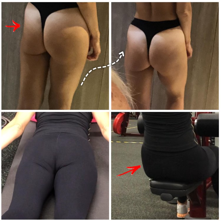 Бедра и ягодицы