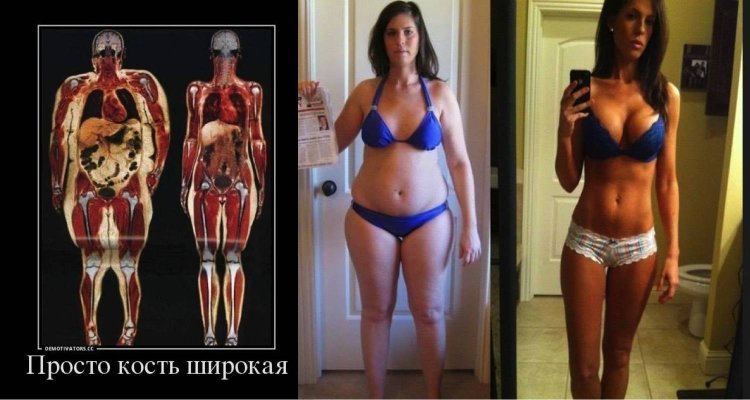 Широкая кость