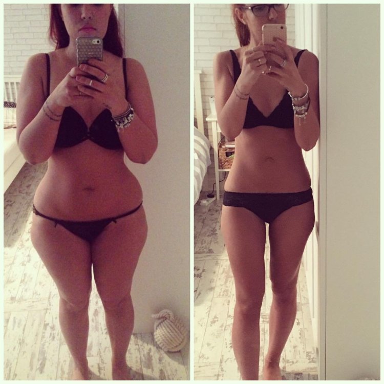 Толстые ноги до и после похудения