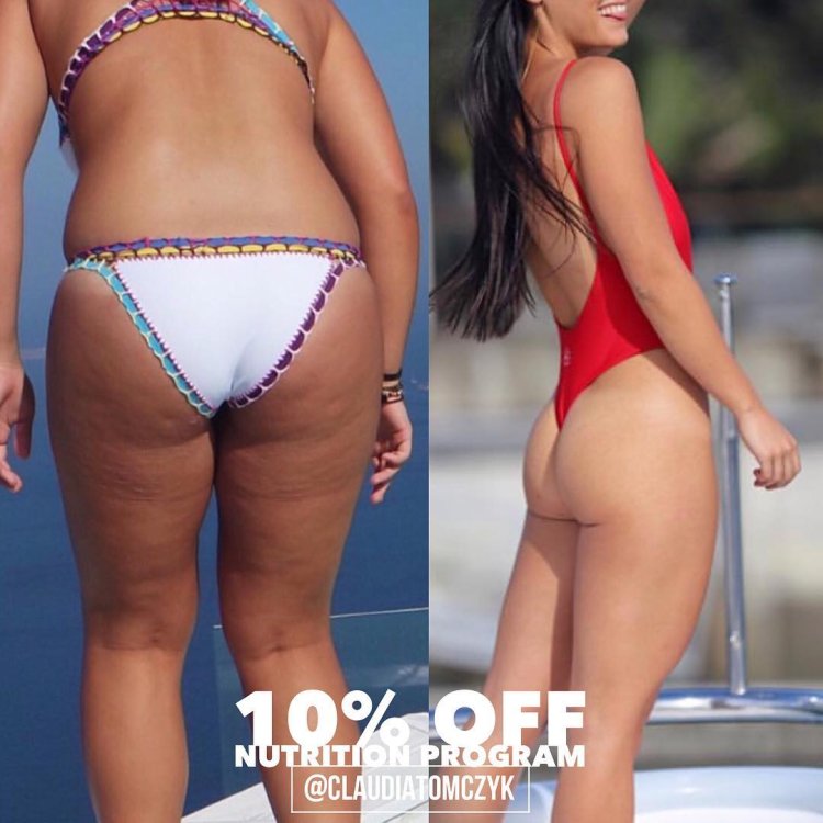 Широкая кость у девушки