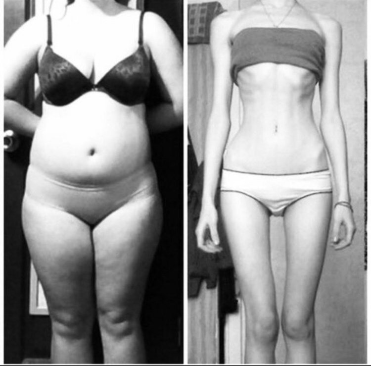 Худые девушки с широкой костью