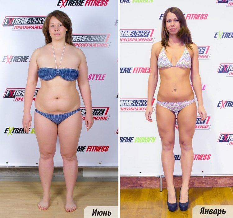 Экстремальное похудение девушки