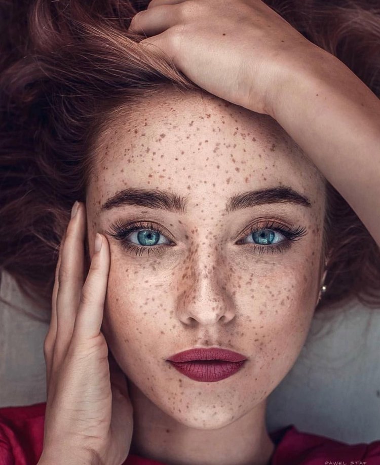 Эмили Коллинз модель с родинками