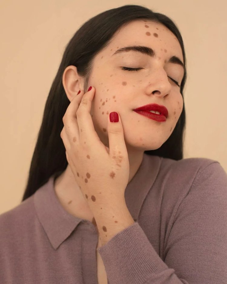 Красивые девушки с родинками