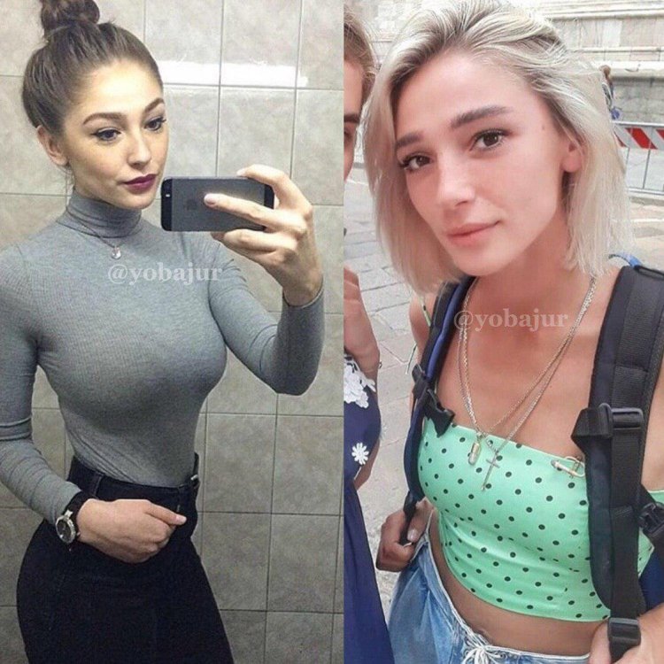 Настя ивлеева до и после пластики