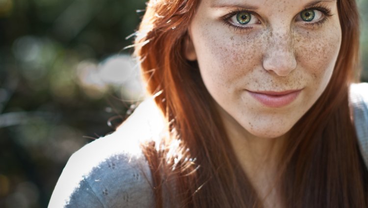 Селина Скиндер веснушки