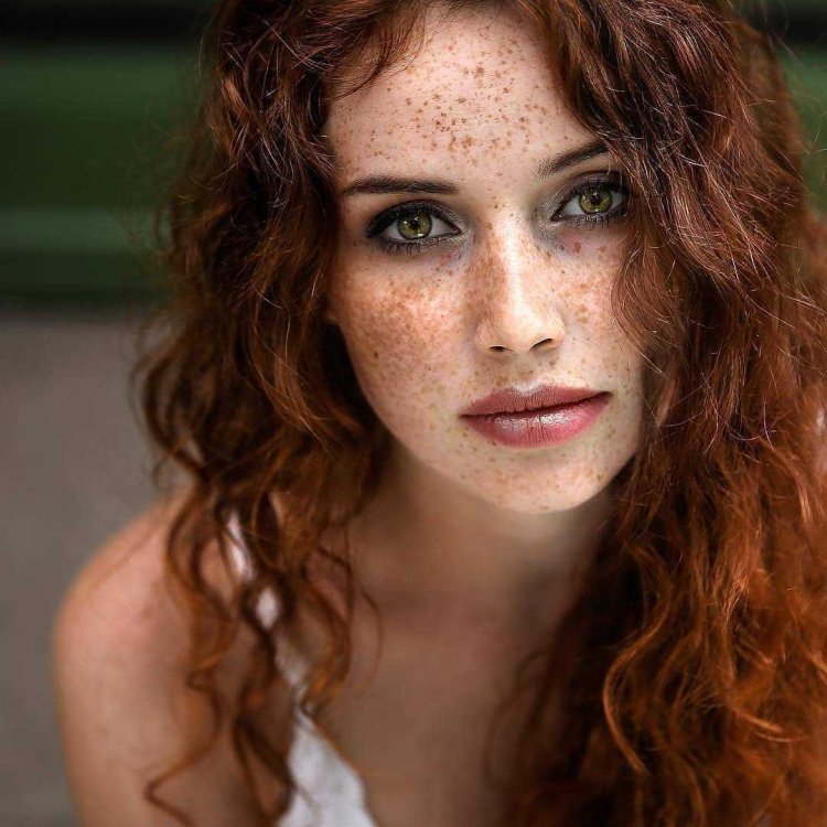Эмма Стоун веснушки