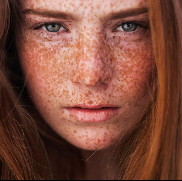 Фэй Рейган веснушки