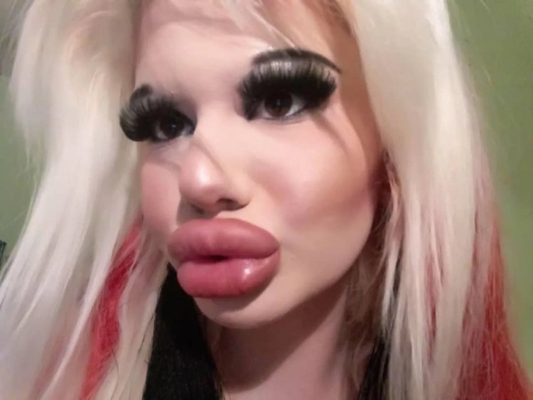 Силиконовые губы