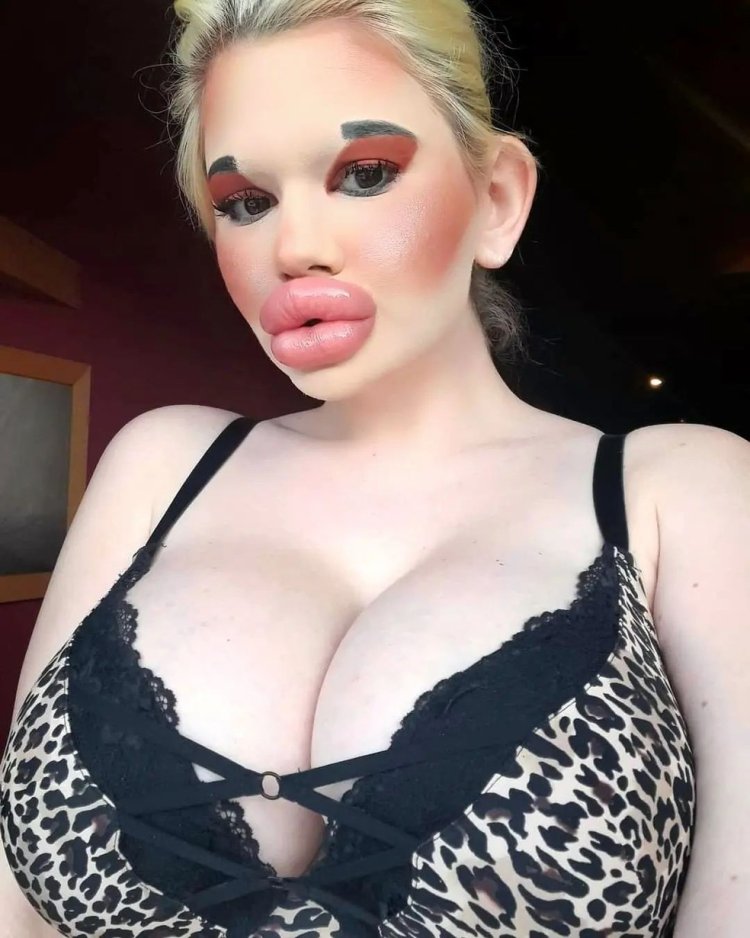 Самые большие губы в мире Андреа Иванова