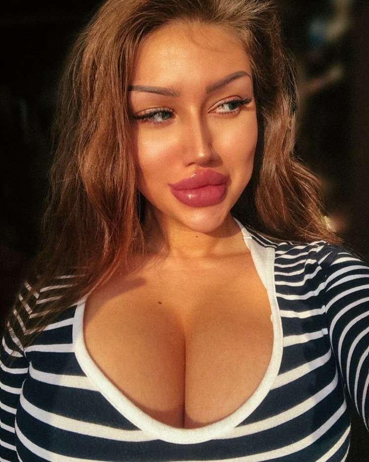 Екатерина Галиченко мукла губы