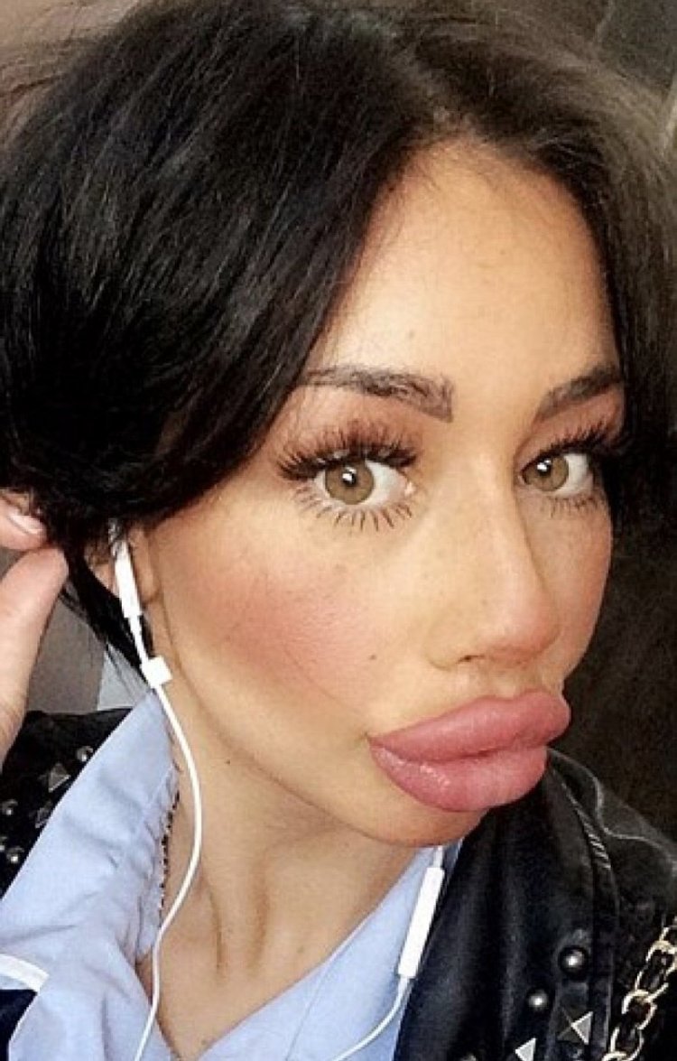 Губошлепка Кайли