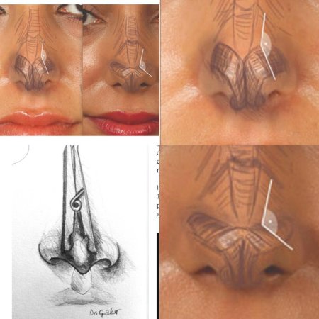 Треугольник референс