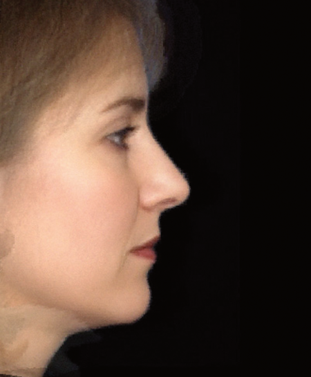 Азиатский нос в профиль